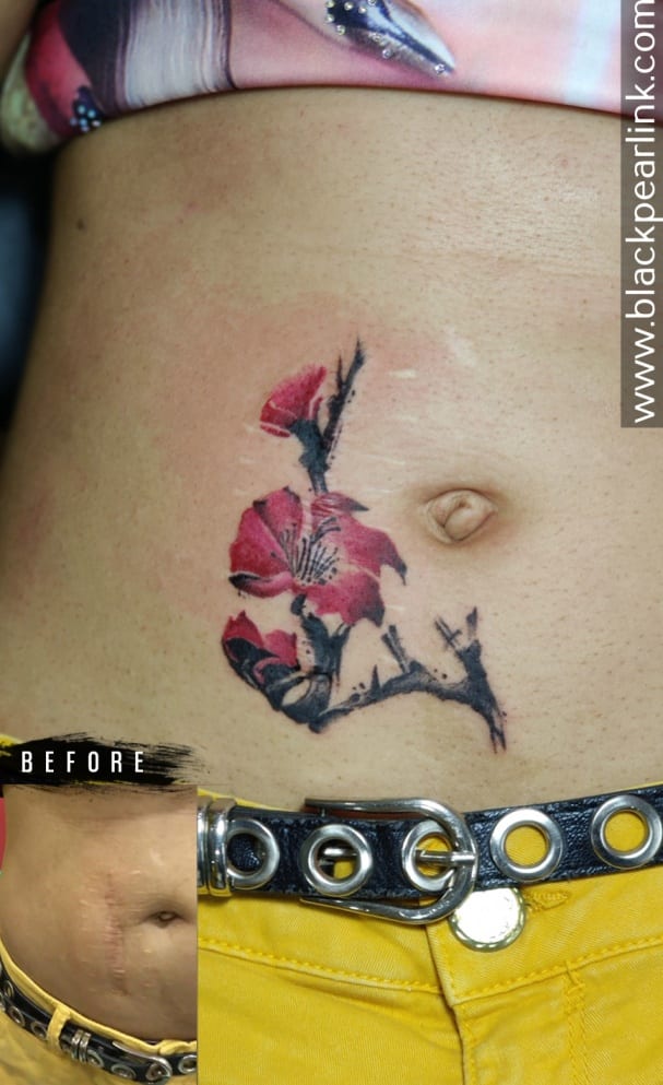 Scar Coverup near Navel with Beautiful Flowers